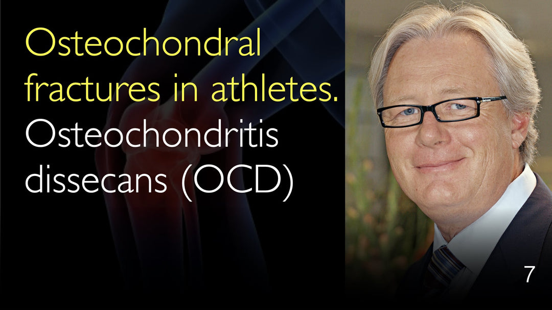 운동선수의 골연골 골절: 골연골염(OCD, Osteochondritis Dissecans)
