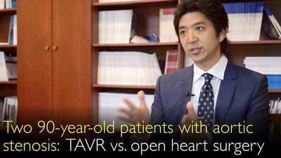 90세 대동맥판협착증 환자 2례: TAVR(경피적 대동맥판막삽입술) 및 대동맥판막치환술을 위한 개심술. 임상 증례. 8