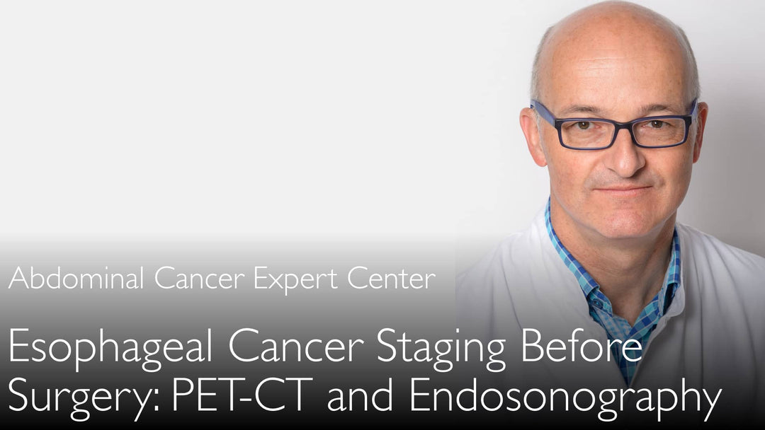 식도암 수술 전 병기 결정을 위한 양전자방출단층촬영-컴퓨터단층촬영(PET-CT) 및 내시경초음파검사. 8