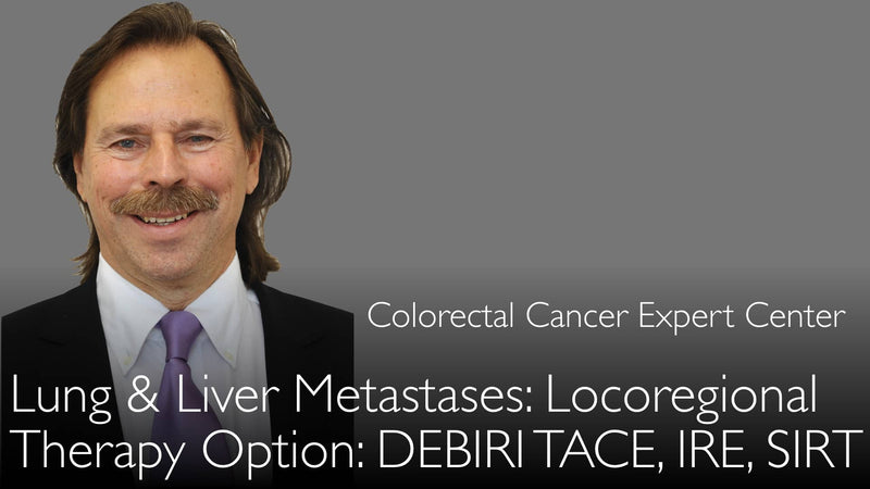 Stage 4 colon cancer. Liver or lung metastases. Locoregional treatment. DEBIRI TACE, IRE, SIRT. 7